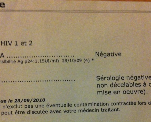 HIV 1